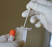 Žmogaus papilomos virusas (ŽPV): ką svarbu žinoti apie simptomus, tyrimus ir prevenciją – gydytojos akušerės-ginekologės įžvalgos