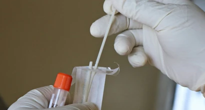 Žmogaus papilomos virusas (ŽPV): ką svarbu žinoti apie simptomus, tyrimus ir prevenciją – gydytojos akušerės